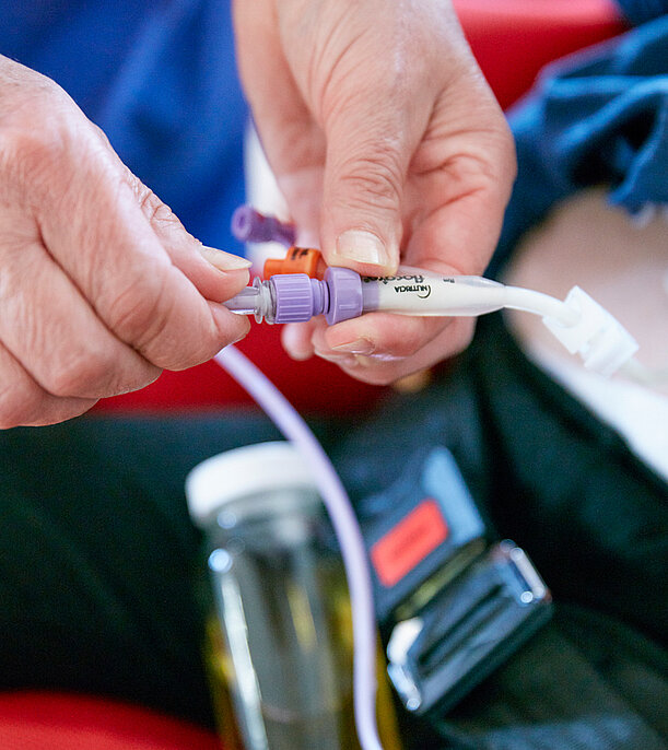 Picture: Nurse prepares feeding via an already inserted gastric tube