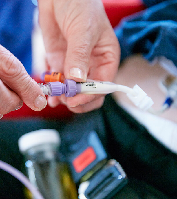  Picture: a gastric tube is prepared to feed a patient
