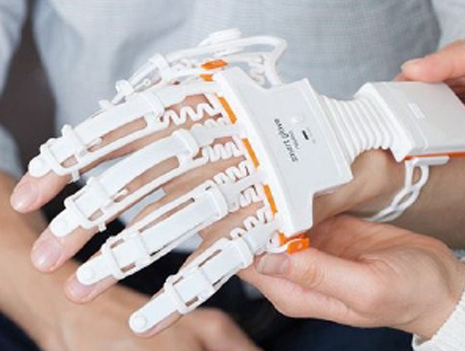 Bild: Ein Patient kann mit Hilfe eines digitalen Handschuhs und eines Bildschirms seine Greiffähigkeit üben